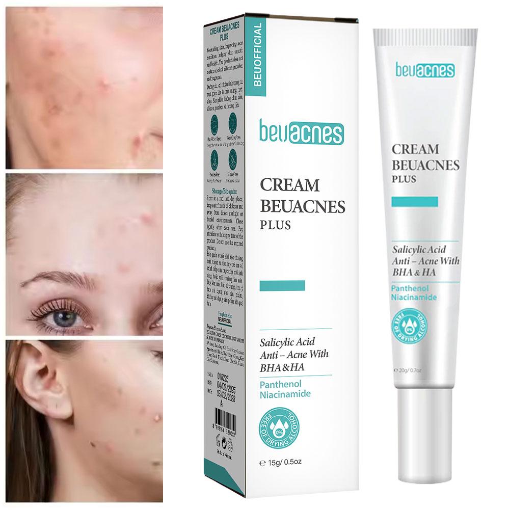 New 20g Niacinamide Acne Gel A - Skincare Salicylic Acid ulasan dan harga