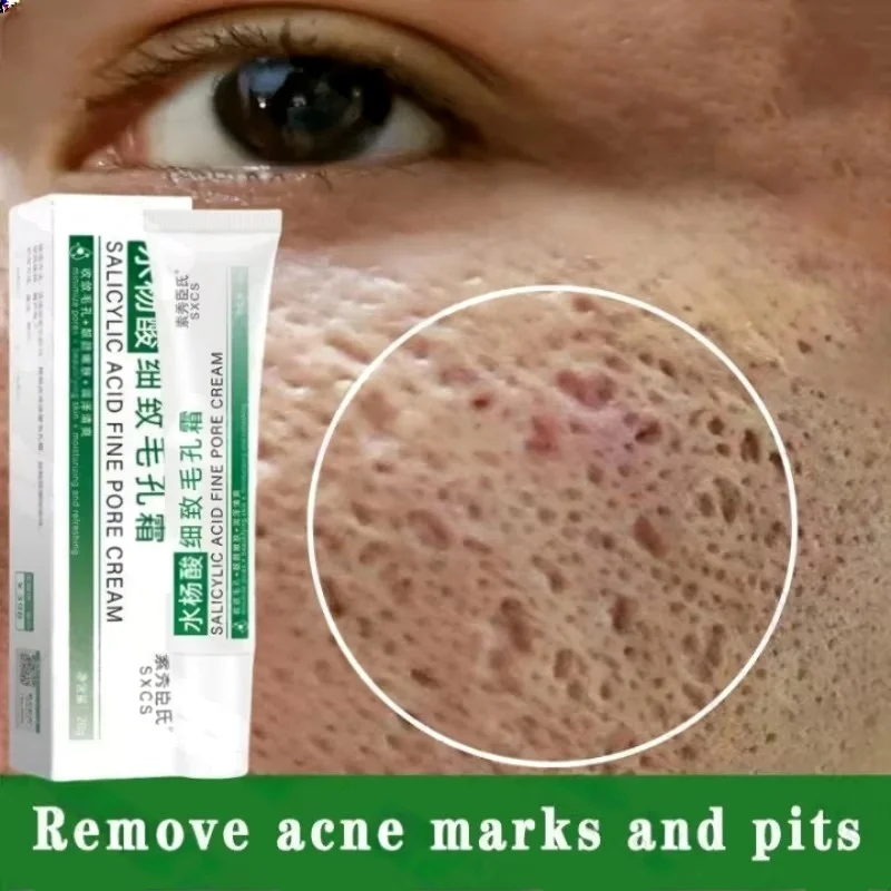 Salicylic Acid Pore Clearing C - Skincare Salicylic Acid ulasan dan harga