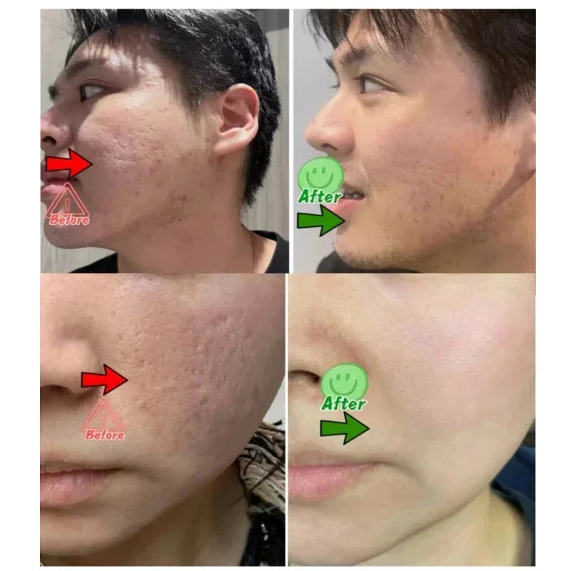 Salicylic Acid Pore Clearing C - Skincare Salicylic Acid ulasan dan harga