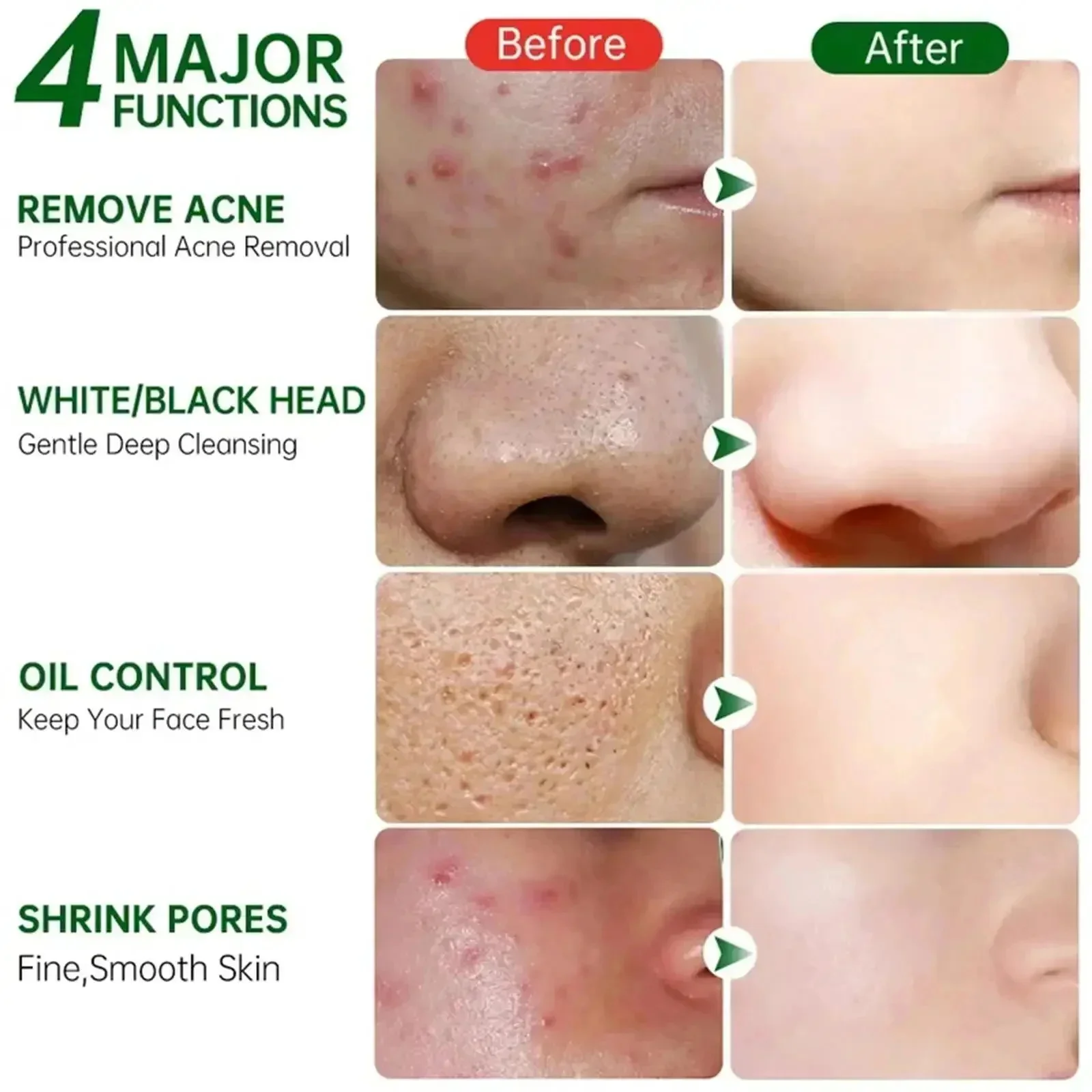 Salicylic Acid Pore Clearing C - Skincare Salicylic Acid ulasan dan harga