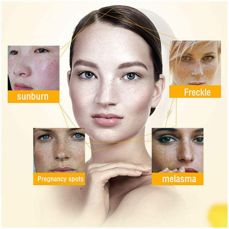 Dimollaure Whitening Freckle C - Skincare Herbal ulasan dan harga