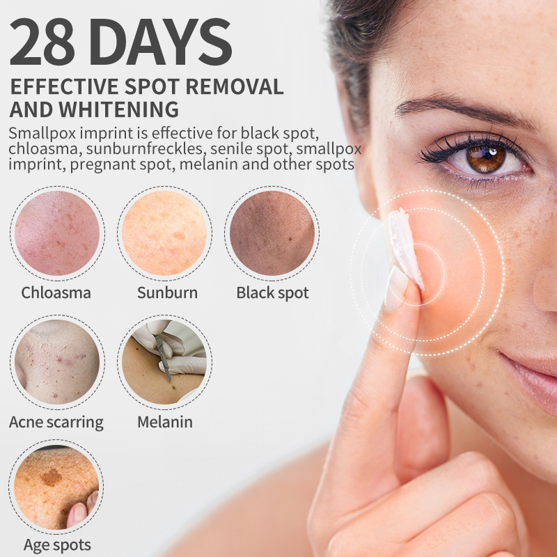 Dimollaure Whitening Freckle C - Skincare Herbal ulasan dan harga