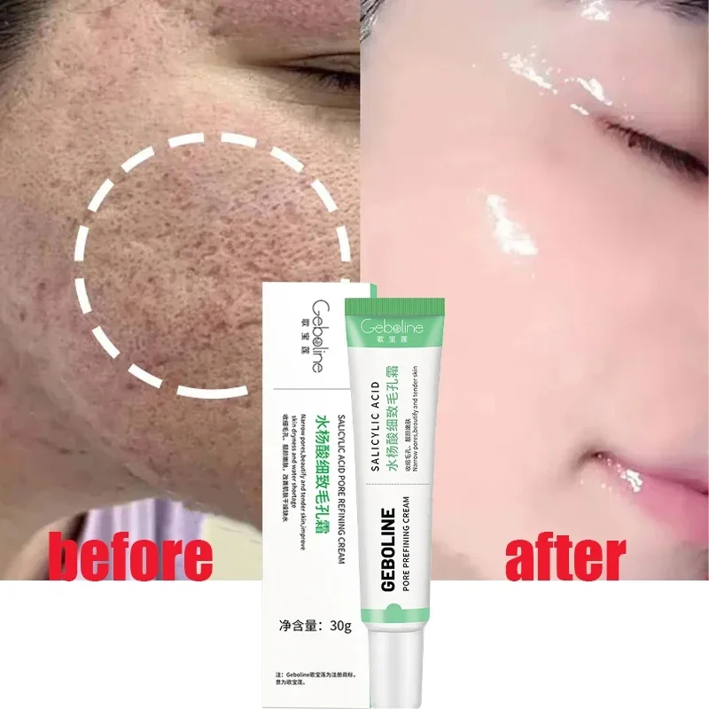 Salicylic Acid Pore Shrinking  - Skincare Salicylic Acid ulasan dan harga