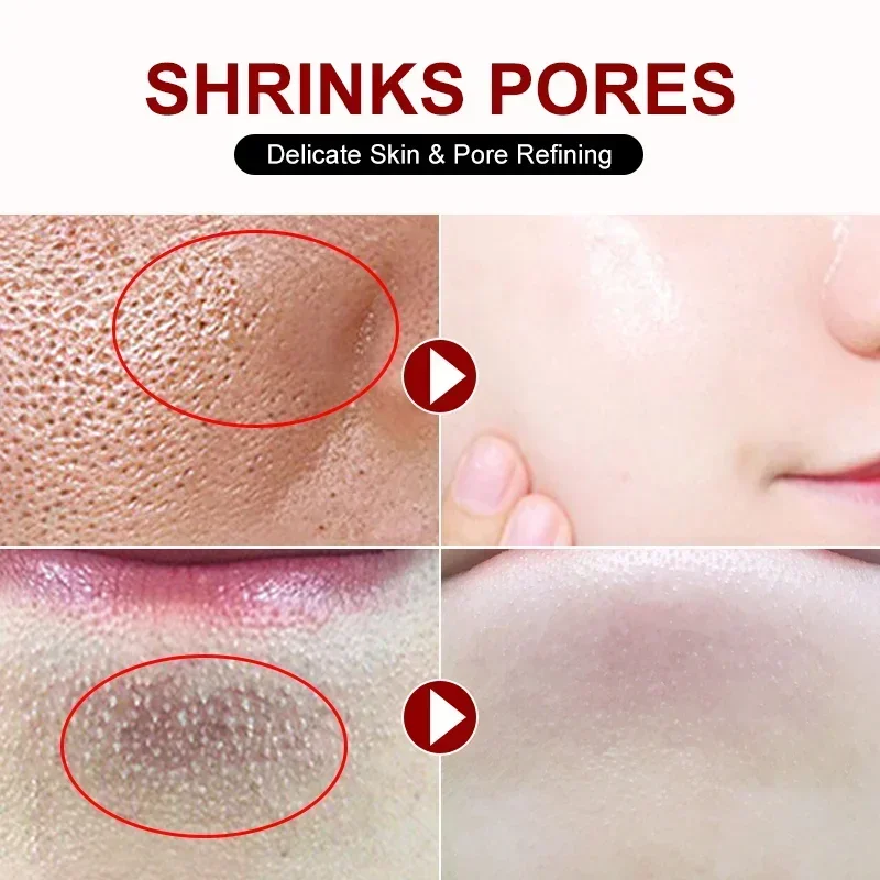 Salicylic Acid Pore Shrinking  - Skincare Salicylic Acid ulasan dan harga