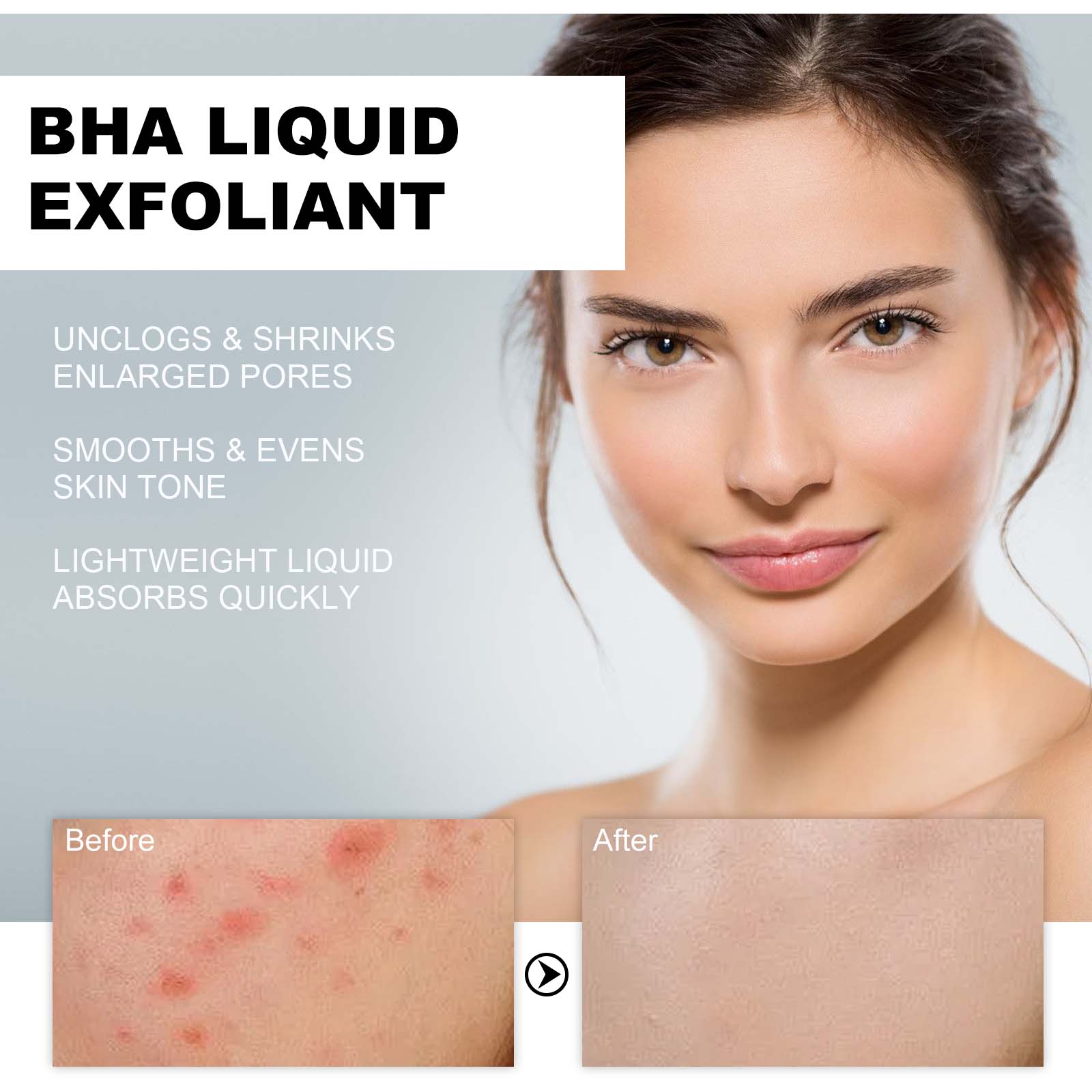 2% Salicylic Acid Liquid Exfol - Tranexamic Acid Serum ulasan dan harga