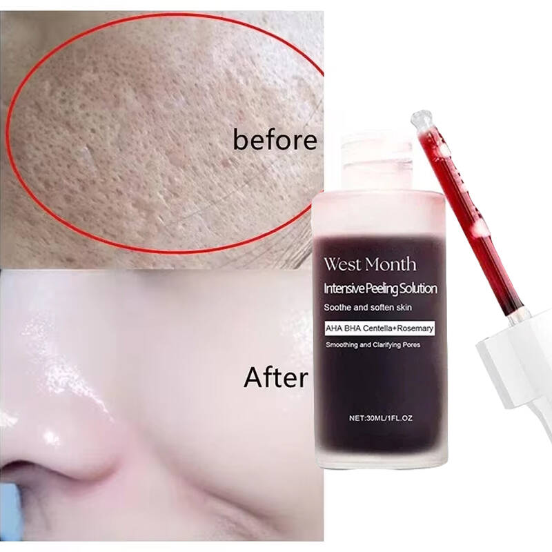 Feels Like Silk, Looks Like Fi - Tranexamic Acid Serum ulasan dan harga