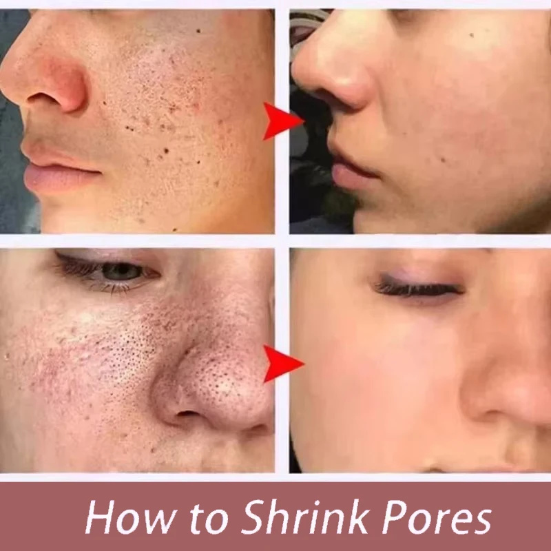 Feels Like Silk, Looks Like Fi - Tranexamic Acid Serum ulasan dan harga