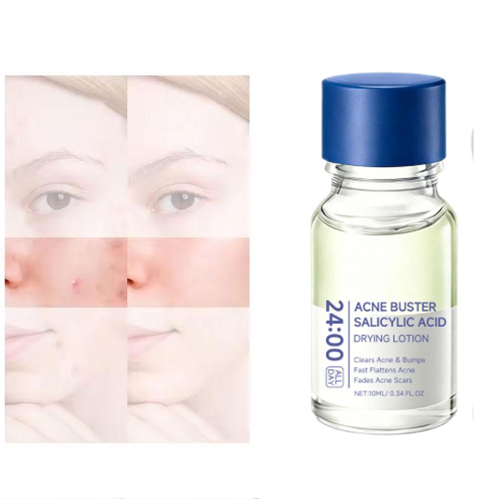 Salicylic Acid Essence Treatme - Tranexamic Acid Serum ulasan dan harga