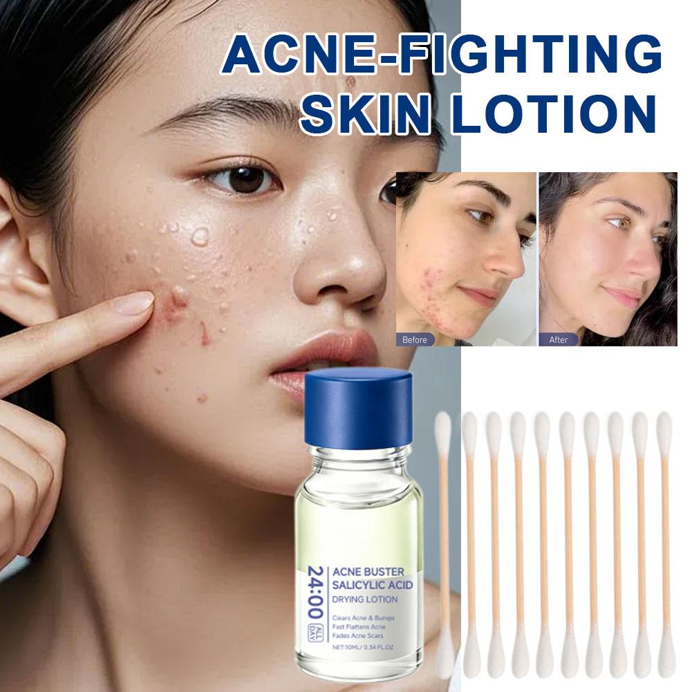 Salicylic Acid Essence Treatme - Tranexamic Acid Serum ulasan dan harga