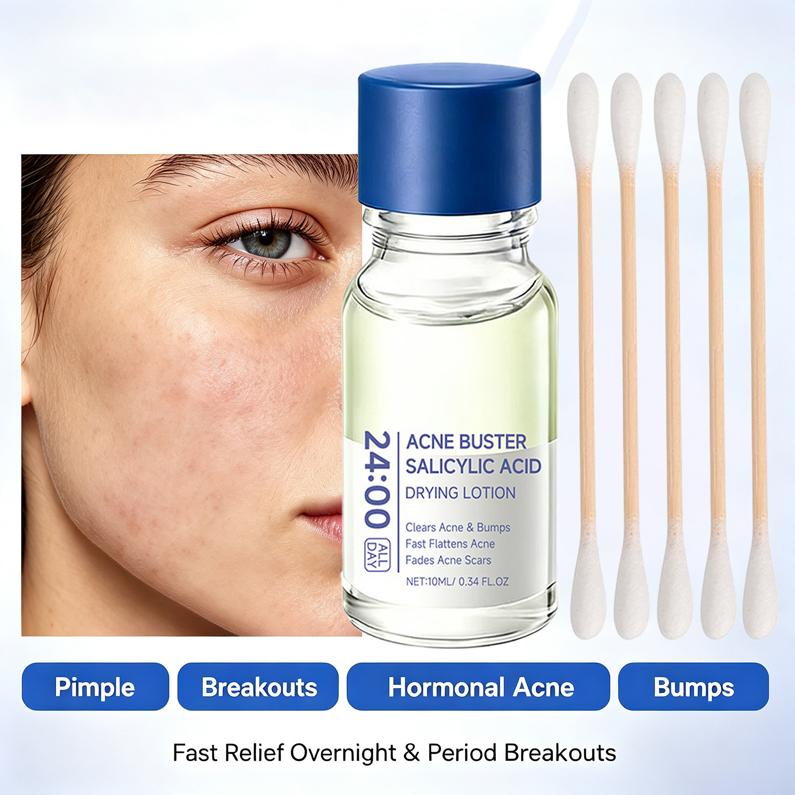 Salicylic Acid Acne Treatment  - Tranexamic Acid Serum ulasan dan harga