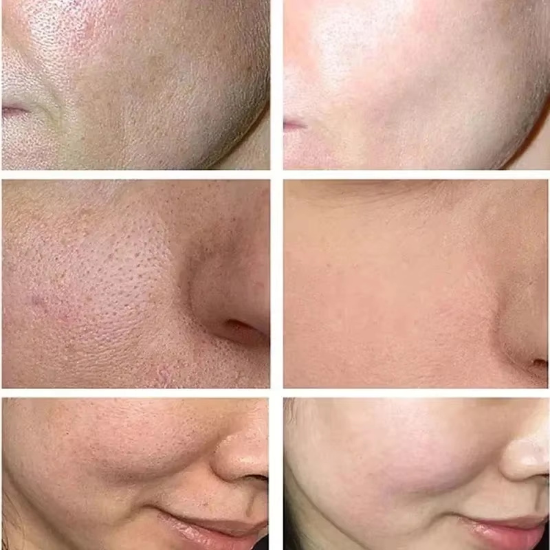 Salicylic Acid Pore Shrinking  - Skincare Salicylic Acid ulasan dan harga