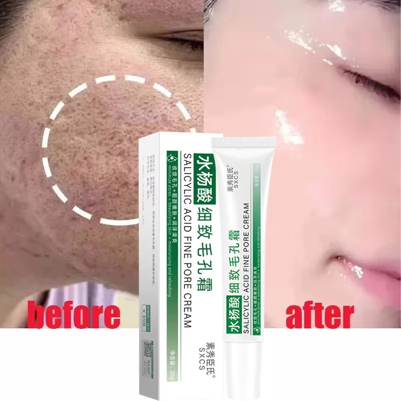 Salicylic Acid Pore Shrinking  - Skincare Salicylic Acid ulasan dan harga