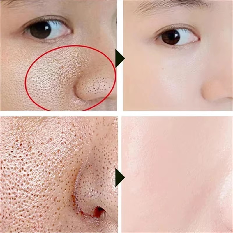Salicylic Acid Pore Shrinking  - Skincare Salicylic Acid ulasan dan harga