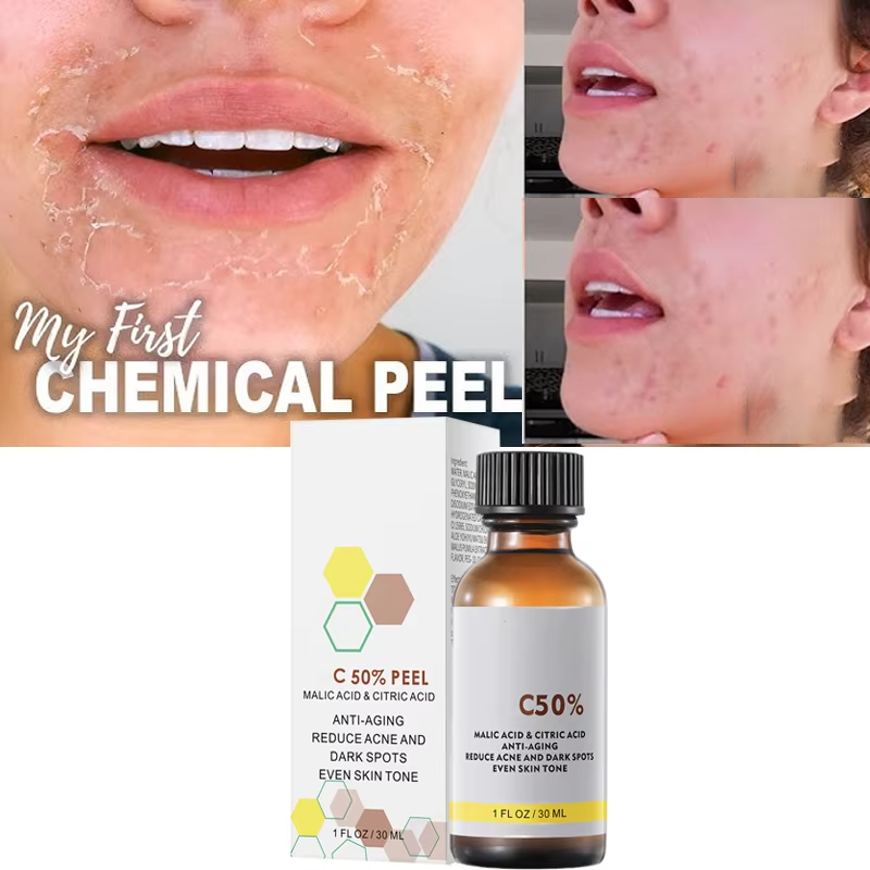 With Malic Acid And Citric Aci - Tranexamic Acid Serum ulasan dan harga