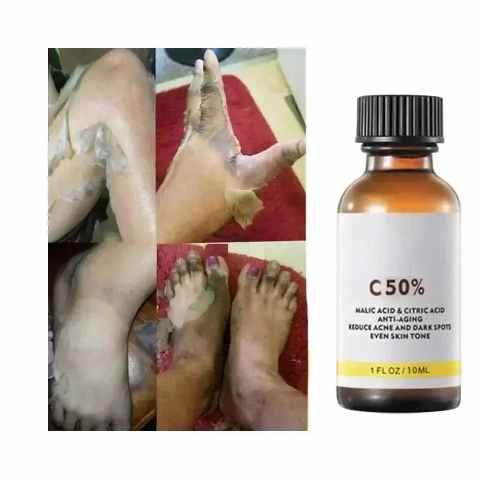 With Malic Acid And Citric Aci - Tranexamic Acid Serum ulasan dan harga